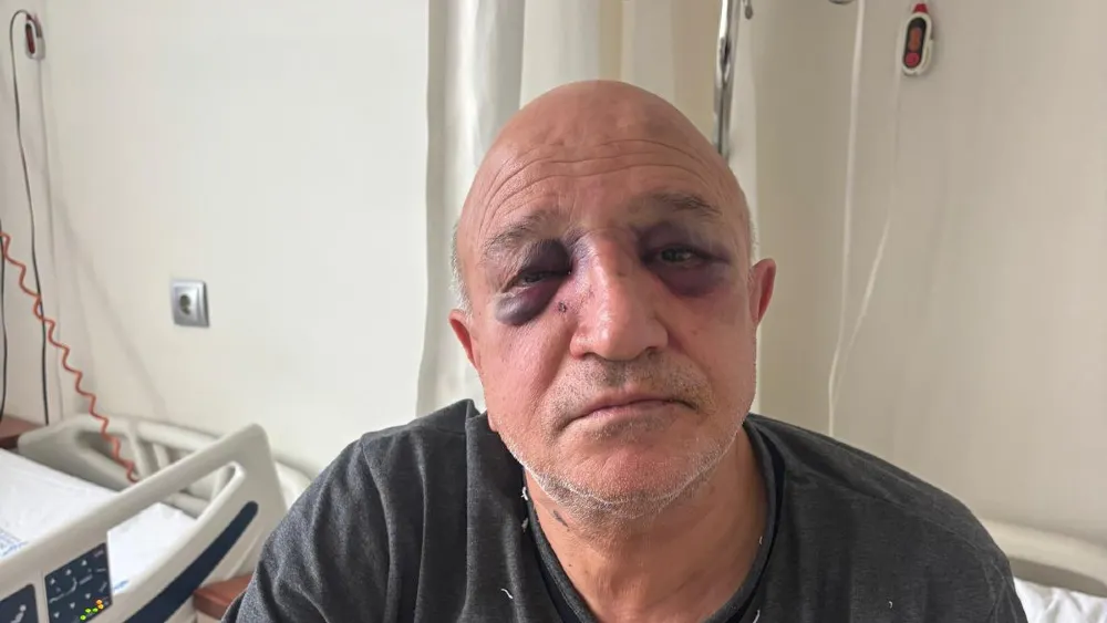 İzmir Büfeciler Odası Başkanına pusulu saldırı… Bir kişi yakalandı dört kişi aranıyor